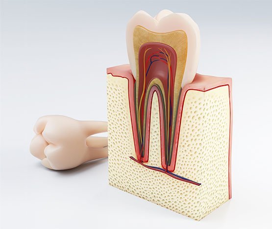 root-canal-treatment-casula