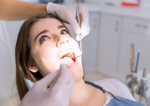 the-tooth-filling-procedure-casula