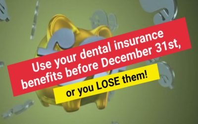 Dental Insurance Benefits: Use it or Lose it! | Casula Dental Care