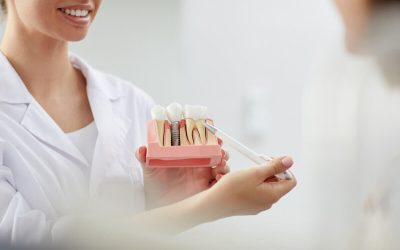 Top 6 Reasons Dental Implants are the Optimal Choice for Replacing Missing Teeth