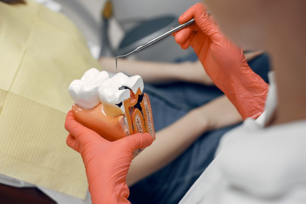 save your tooth with root canal treatment dentist casula