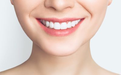 Whiter, Brighter, Confident: The Power of Professional Teeth Whitening